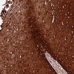 ZNF286B Antibody, Novus Biologicals:Antibodies:Primary Antibodies